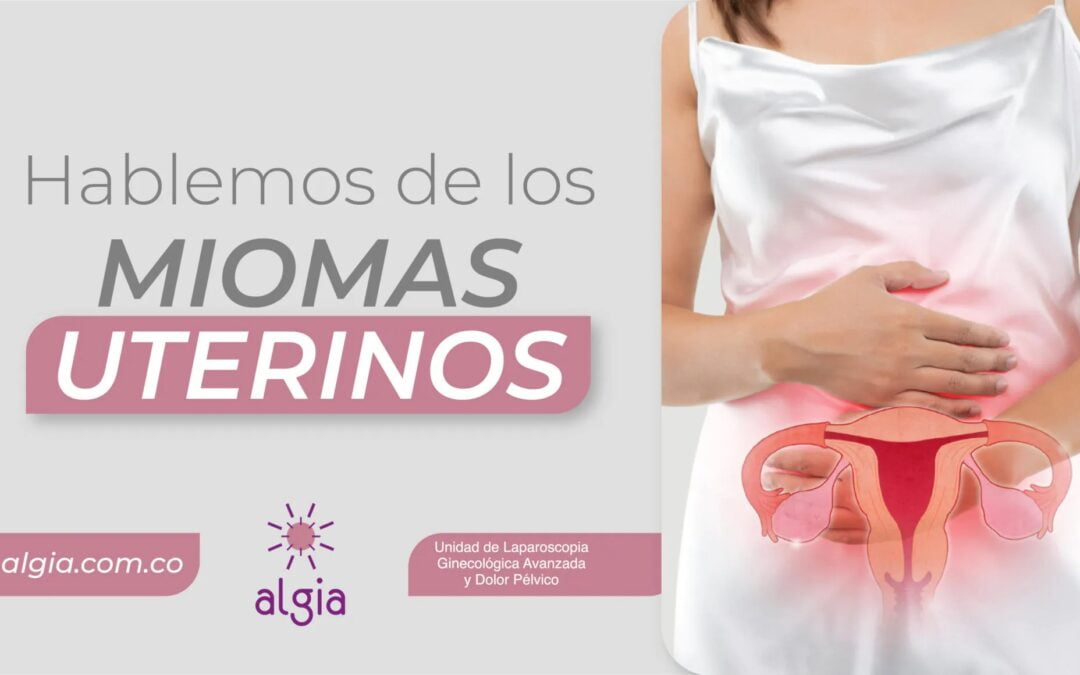 Hablemos de miomas uterinos